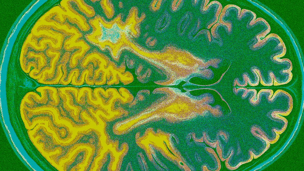 How to Get Rid of Brain Fog: 52 Tips and Fixes