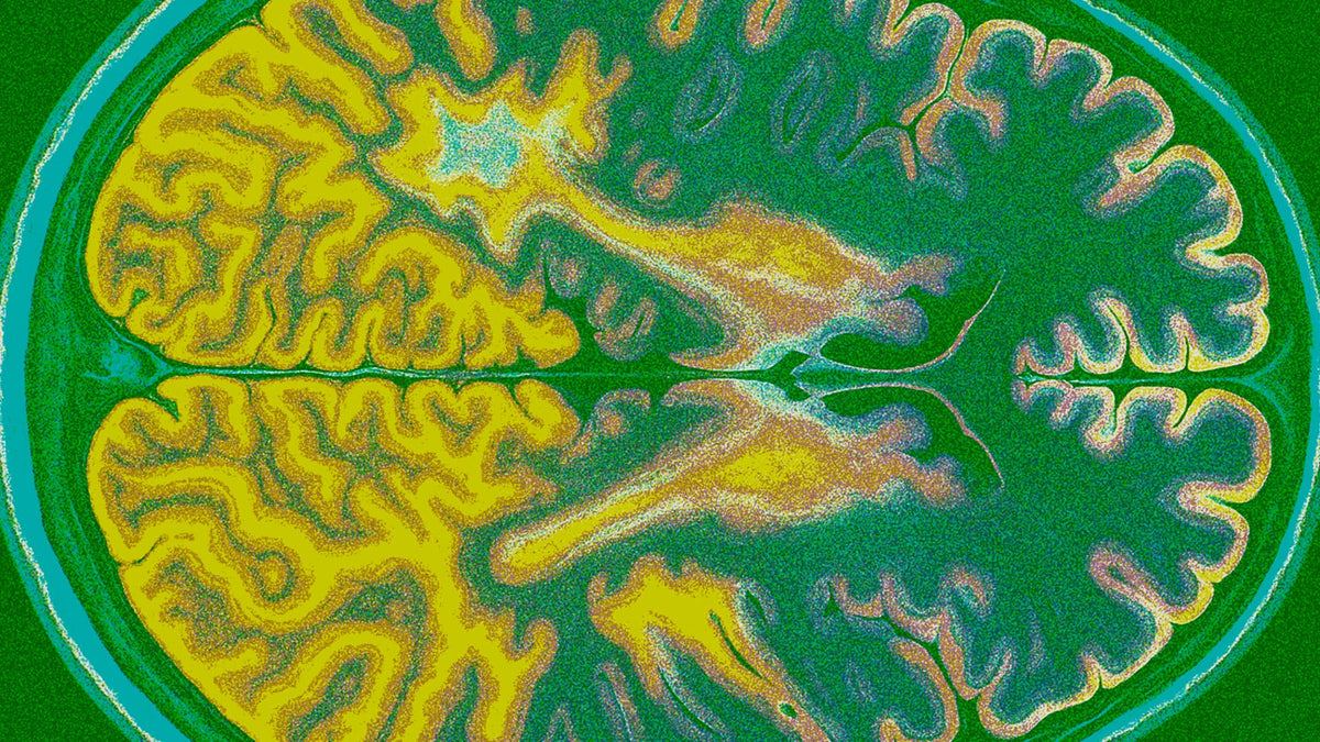 How to Get Rid of Brain Fog: 52 Tips and Fixes